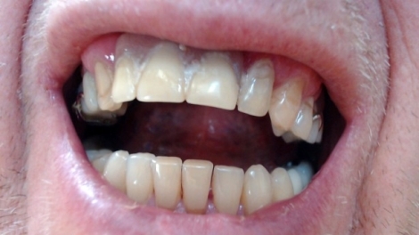 dental surgery case