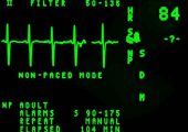 EKG Machine
